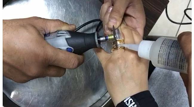 Genç kızın parmağında sıkışan yüzüğü itfaiye çıkardı