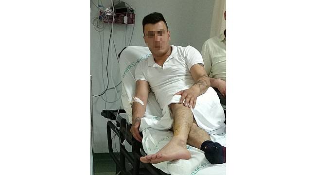Samsun'da silahlı saldırı: 1 yaralı